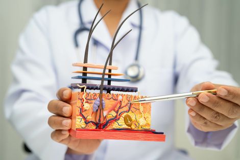 Foto: Haarwurzeltransplantation umsatzsteuerfrei
